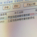 阳性率上升，天冷高发！医生提醒：该病毒对这些人影响更大....._2