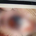 保温杯泡枸杞，竟成“定时炸弹”？!_1