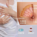 戏如人生 | 七旬大伯乳房肿了三个月，一查局部晚期淋巴结转移了_2