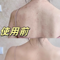 公认最好用的除螨仪是哪个？2025年最受欢迎的除螨仪产品推荐！_0