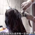 30岁男子1个月染发4次，结果头秃了……医生：真的不建议！_0