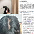 30岁男子1个月染发4次，结果头秃了……医生：真的不建议！_2