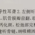 左半边莫西干头，右半边中长卷发，我在病友注目礼下进了手术室_4