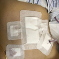 切掉一段肠、冻好卵，我休息3天回到医院开始12程化疗