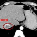 女生拿手电筒照手，网友发现不对劲！医生：这些危险信号要当心_2