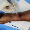 男子拆快递时切断大动脉，鲜血直喷！还有人拆完腹痛腹泻……_4