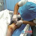 近期激增！一旦发病，致死率几乎100%_1