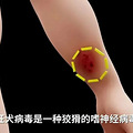 近期激增！一旦发病，致死率几乎100%_0