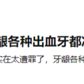 冲牙器会导致牙缝变大吗？提防四大危害乱象！_3