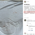 泡脚“鱼疗”后，她被截掉了5个脚趾！这些人千万不要随意尝试_3