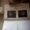 【孕妈日记】宝贝的突然来临，让我又惊又喜