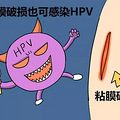 HPV��ⱨ�����������HPV��ʲô����_4