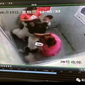 3岁男童电梯里被大型犬袭击，脸上抓出10厘米血印！妈妈一查监_4
