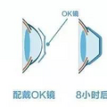 OK镜，让孩子近视度数“刹车”的神器_0