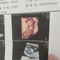 【孕妈日记】一波三折，从怀孕到生我住了三次院！_0