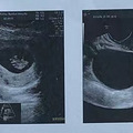 【孕妈日记】披荆斩棘的妈妈_4