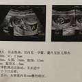 【孕妈日记】披荆斩棘的妈妈_0