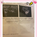 孕期费用初盘点【2022孕妈日记】_1
