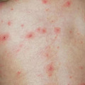 【育儿说】毒疫苗、二类疫苗、非法疫苗、失效疫苗，很多人搞不懂_4