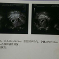 意外而来的惊喜+【2022我的孕妈日记】_1