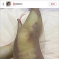 4名中国公民遇难！韩国踩踏事故遇难人数升至151人_4