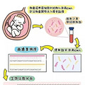 唐筛、无创、羊穿怎么选？看这篇就清楚了_0