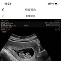 2024孕妈日记