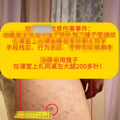 “女生被同桌扎218针”，未达到校园霸凌标准？多方发声
