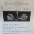 母子平安！孕4月开腹取出30公分肌瘤，孕9月顺利生娃！_4