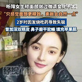 曾因“长相太完美”登热搜第一，美院聋哑女生已承认多处微调_2
