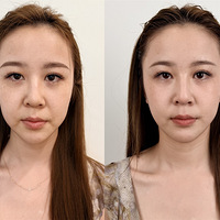 �����������룡����һ�����꼪����ʵ��˥Ч����ѡ��ҽ������Ҫ