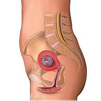 名模怀孕上T台 赚钱又赚眼球-育儿问答-杭州19