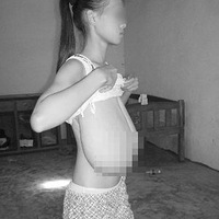 健康图片 <em>吸烟有害</em>健康图片 健康教育图片-公社