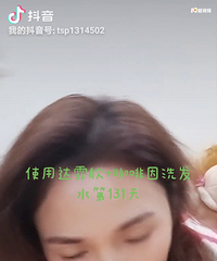 秃星人的救星,只需要坚持就行了,头发一天天就长出来了