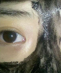 准备明天开眼角。更新(拆线老)