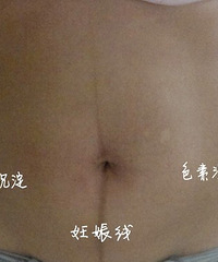深坑大图慎入,护肤、妊娠纹、色素沉淀都进来,另PO久违彩妆一枚