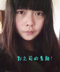 开双眼皮。三点定位+抽脂,更新到2个月效果