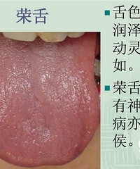 包子妈出品—浅谈 小儿急诊 感冒 腹泻宝宝常见病的预防和治疗