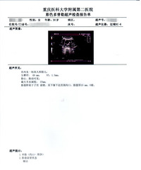 好孕报喜+重医附二院建卡记录~