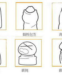 ���ǰ�����ͼ�������вο�