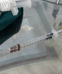 重口味的下巴打玻尿酸