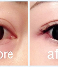 ��MIHO�׺����ޡ������������ֲ�ĸ���-��Ȼ������~