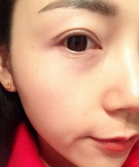 【MIHO米荷美睫】体验归来,种植的感受-依然很美好~