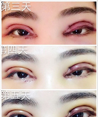 从此以后和【双眼皮君】相亲相爱~~