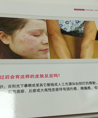 【MIMI脱毛体验】专业的技术,暖心的服务