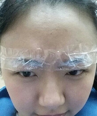 �ü�����Ҫȥ��ǻҽԺ��üë�գ����ֳ�ֱ��