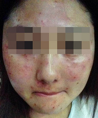参加迪邦色斑抽奖活动归来!(本人亲身经历汇报)