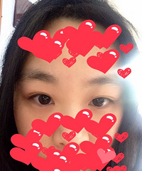 口腔医院纹眼线归来,痛啊!