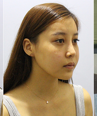 ������Ŀ������+vline