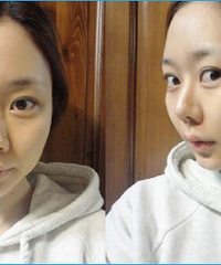 ���������ռǣ��沿֬����ֲ����°�Ҳ������Ӵ